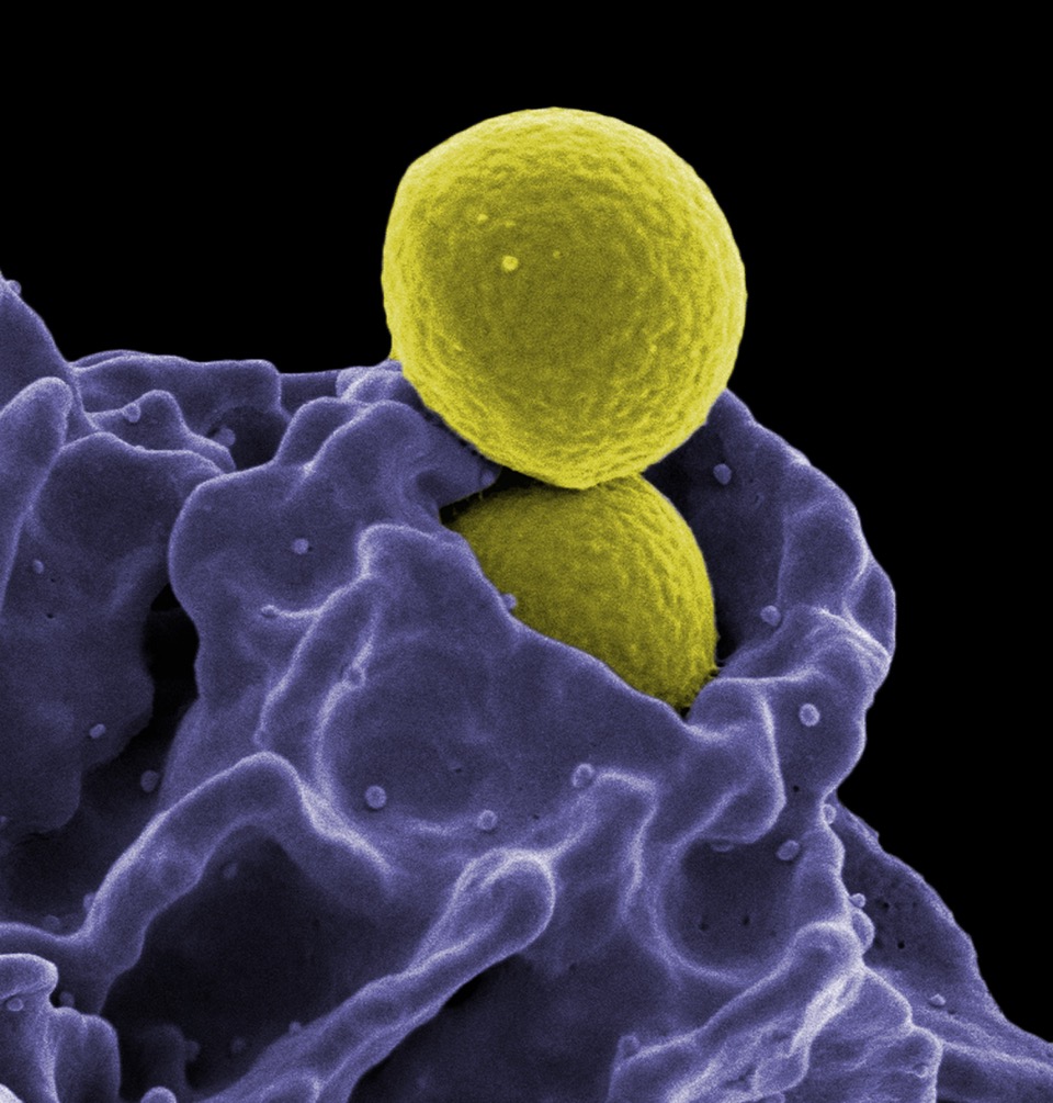 The Immune System and Embracing Wholeness - Galway - November 2026