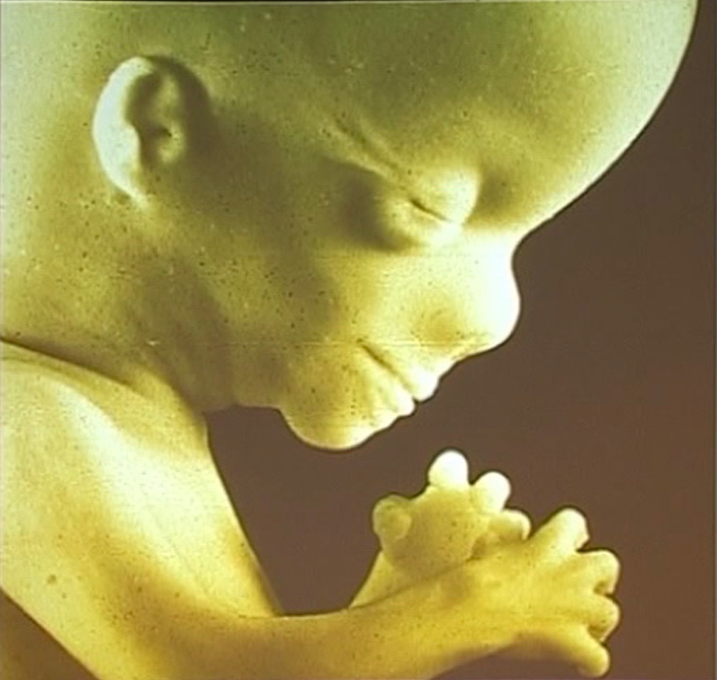 Further into the Face - An Exploration of the Embryological Face-Melbourne-In Person-November-2022