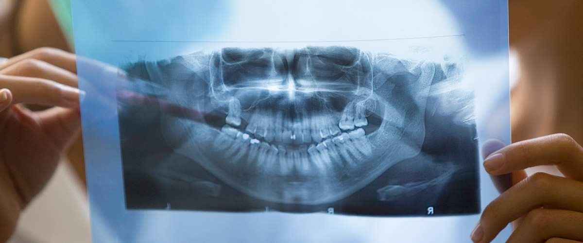 Treatment Spotlight: Oral Surgery