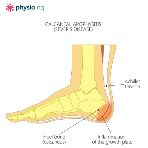 PageData.props.webapp_item_title