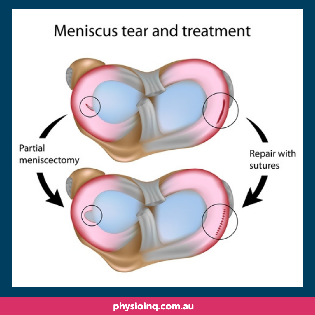 PageData.props.webapp_item_title