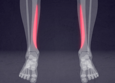 PageData.props.webapp_item_title