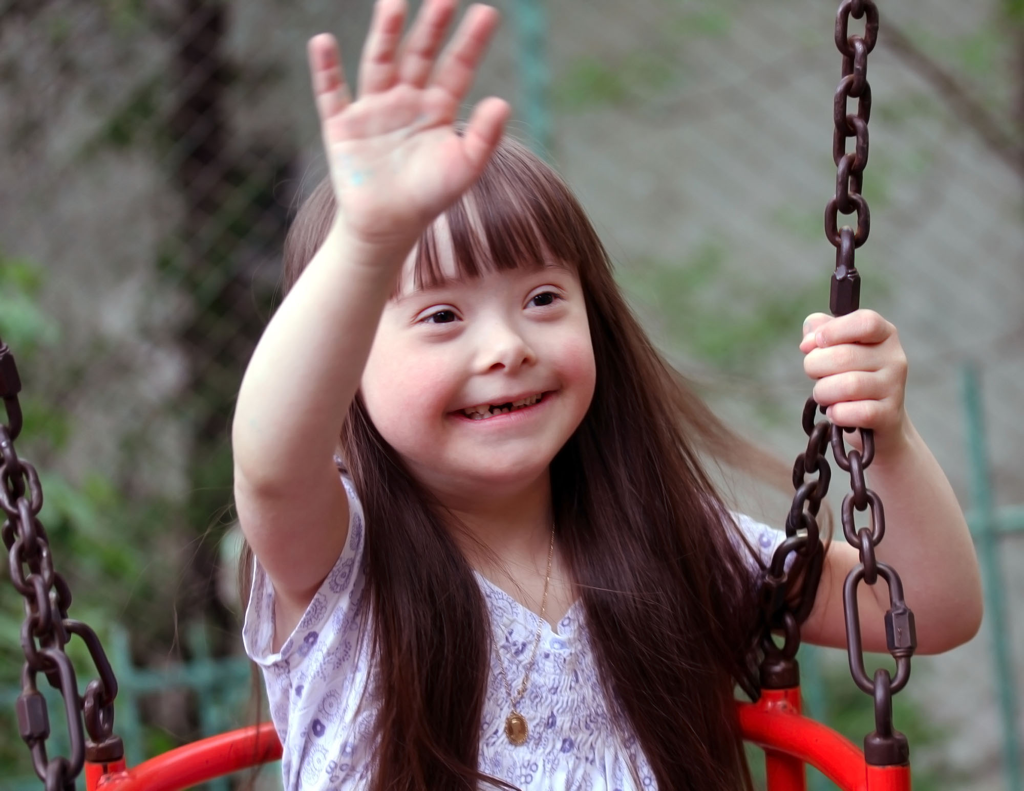 Children With Down Syndrome - Physical Complications & What To Do?