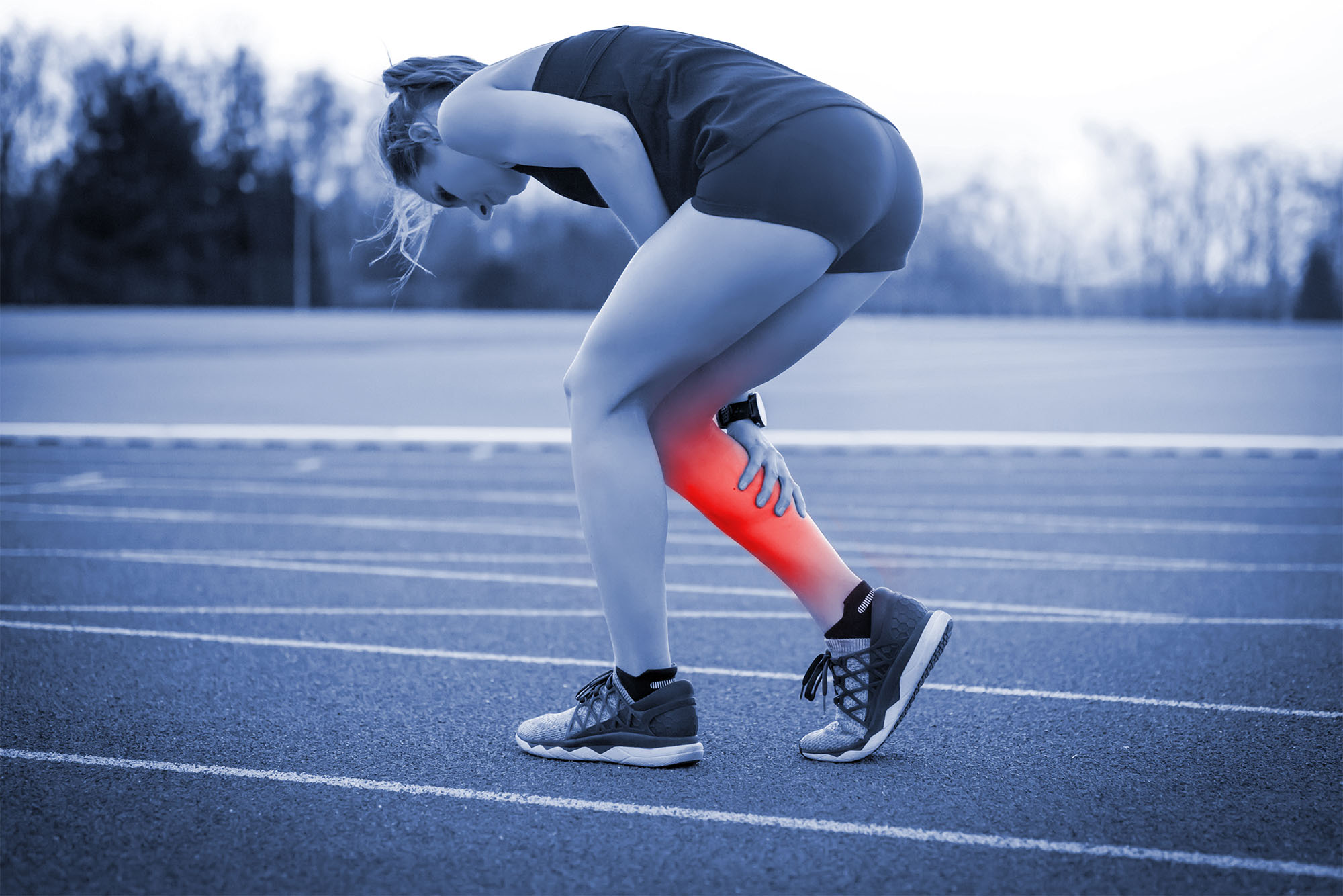 Stress Fractures in Runners