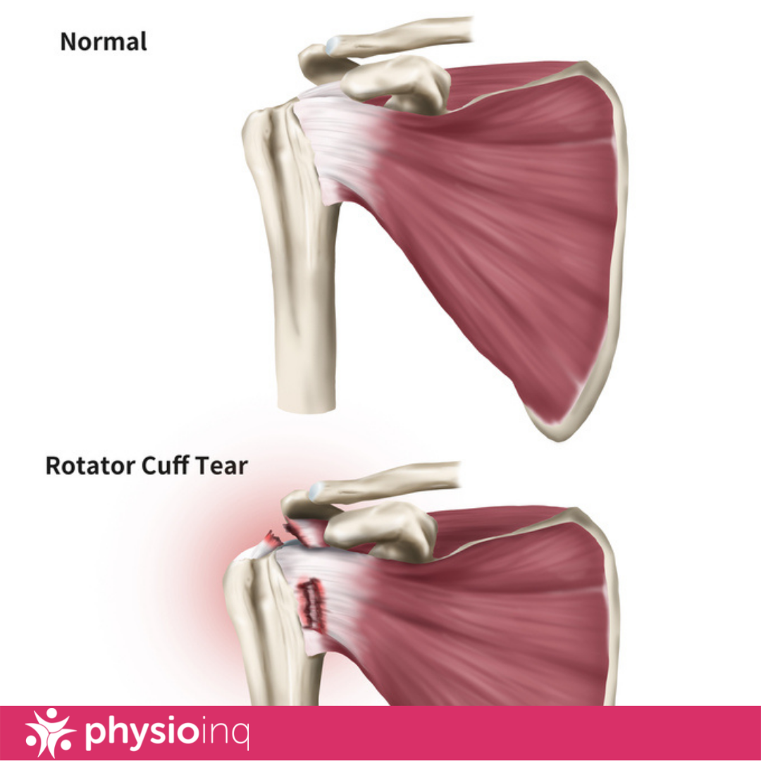 How To Prevent Baseball Injuries. 5 Key Tips