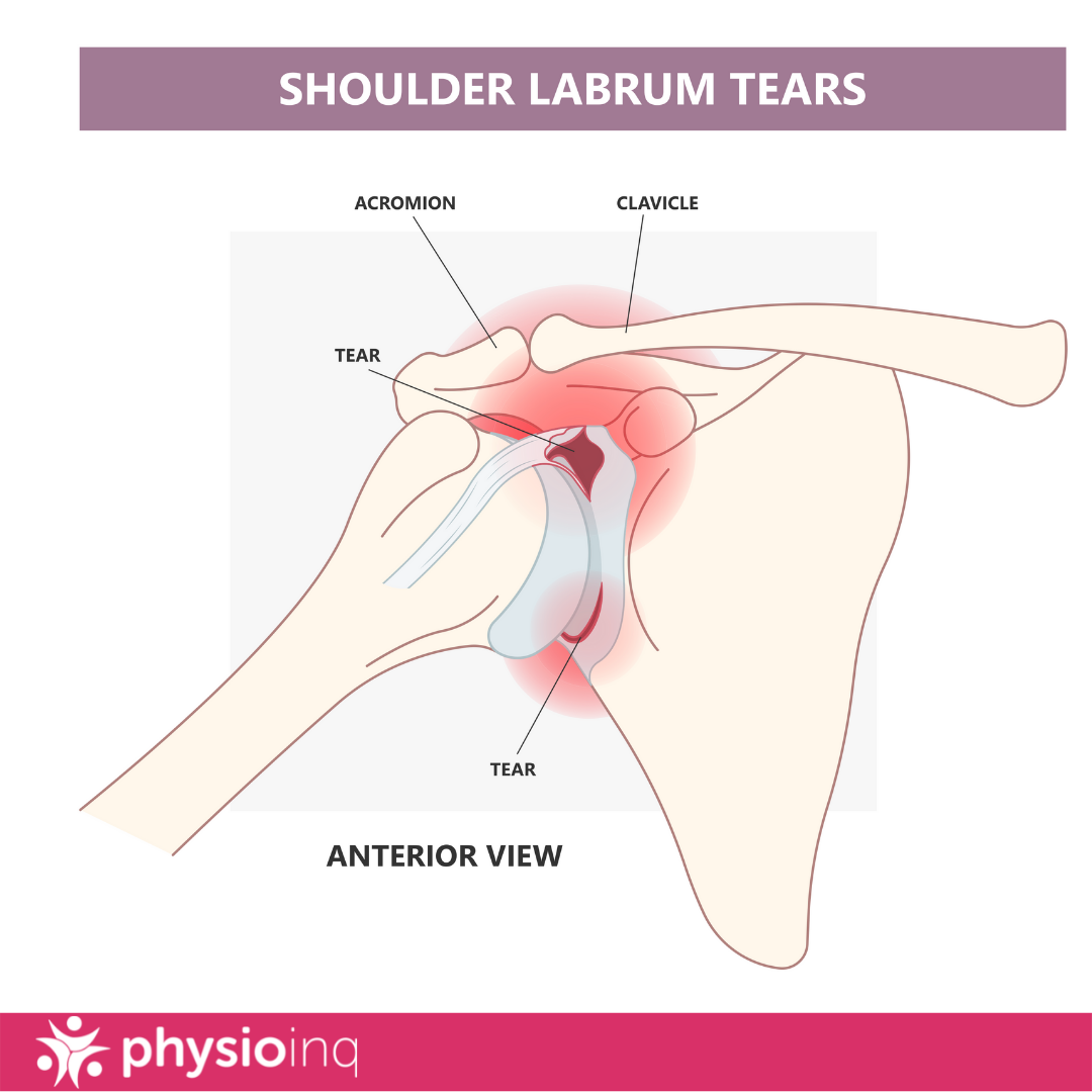 How To Prevent Baseball Injuries. 5 Key Tips