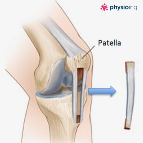 PageData.props.webapp_item_title