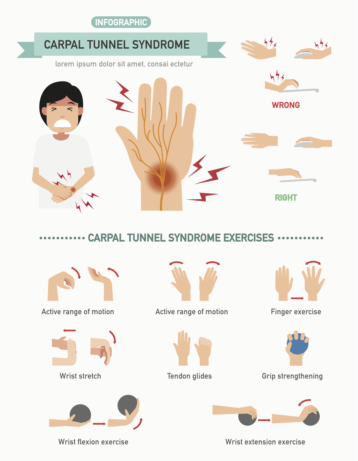 Carpal Tunnel Syndrome Occupational Therapy: Effective Relief Tips