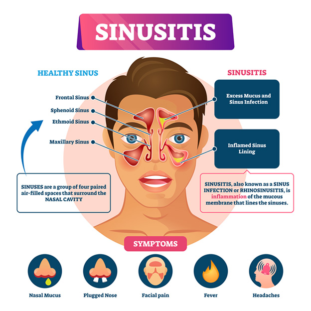 Can Sinus Pressure Cause Neck Pain? All You Need to Understand