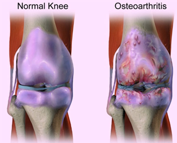 PageData.props.webapp_item_title