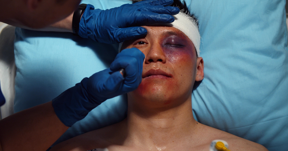 Rehabilitation for Individuals with Traumatic Brain Injury 