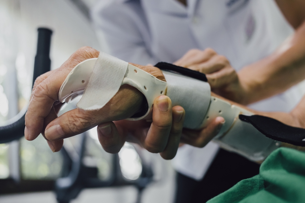 Splinting Techniques for Individuals with Arthritis