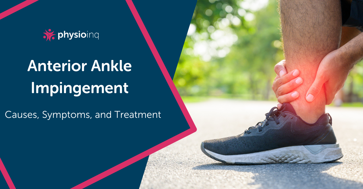 Anterior Ankle Impingement: Causes, Symptoms, and Treatment