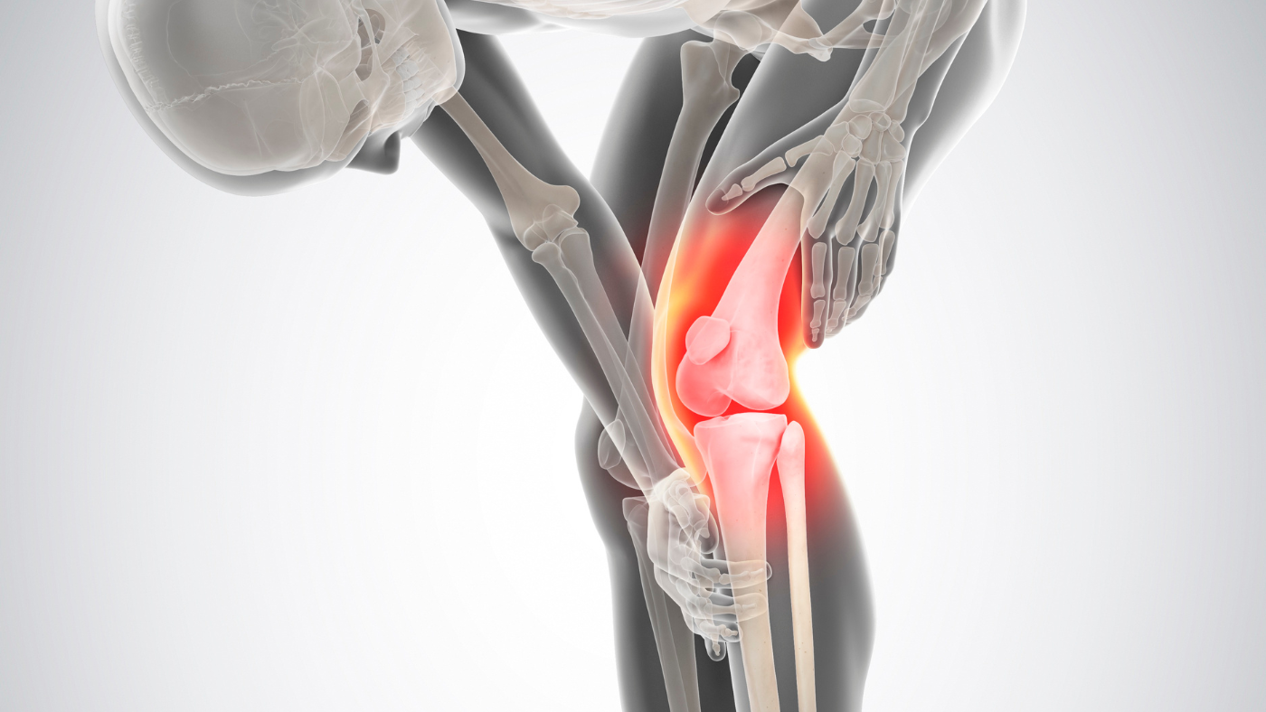 Knee: ACL Injuries