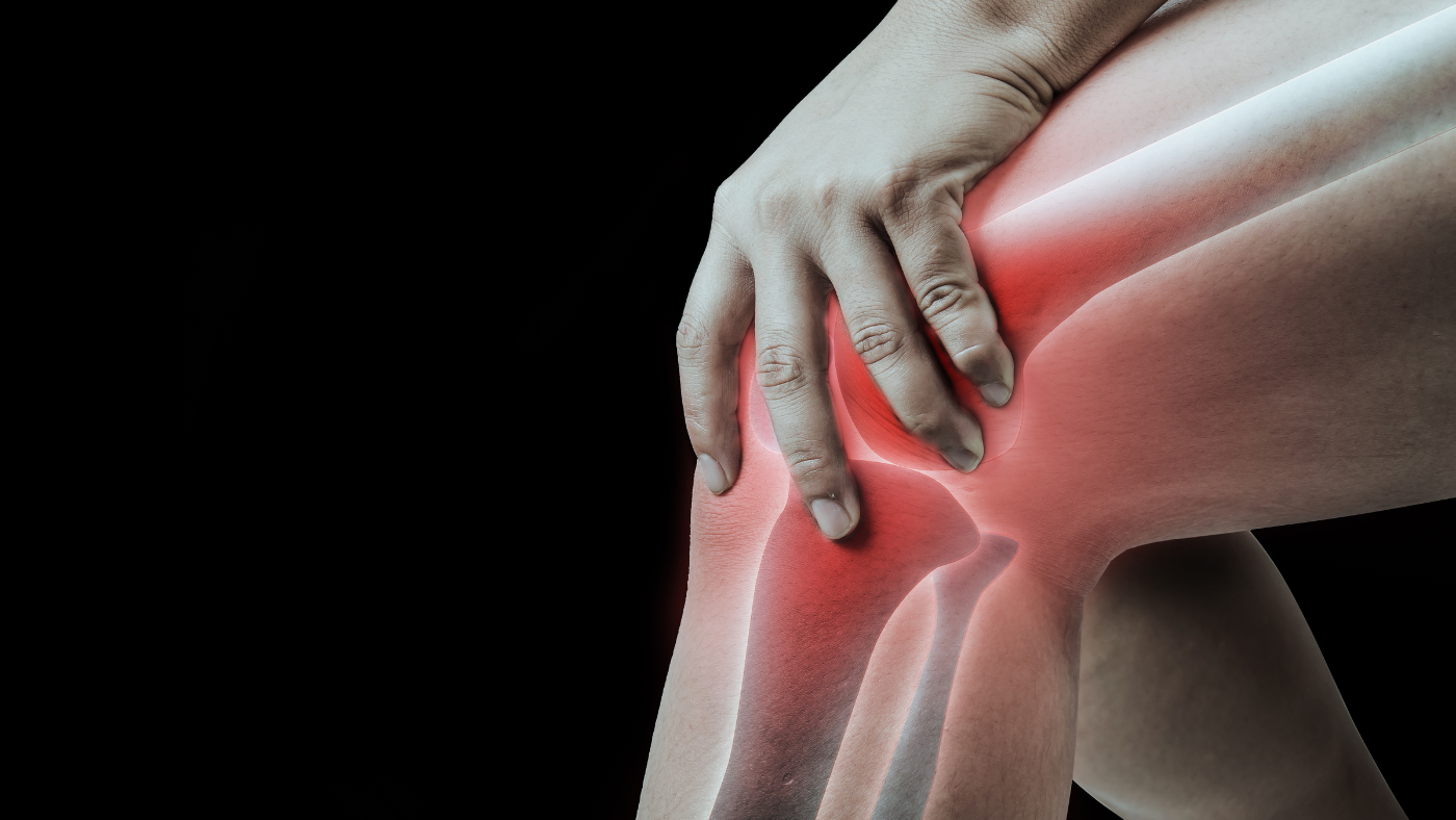 Knee: Osteoarthritis of the Knee
