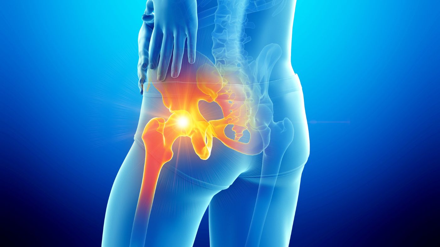 Hip: Femoroacetabular Impingement (FAI)