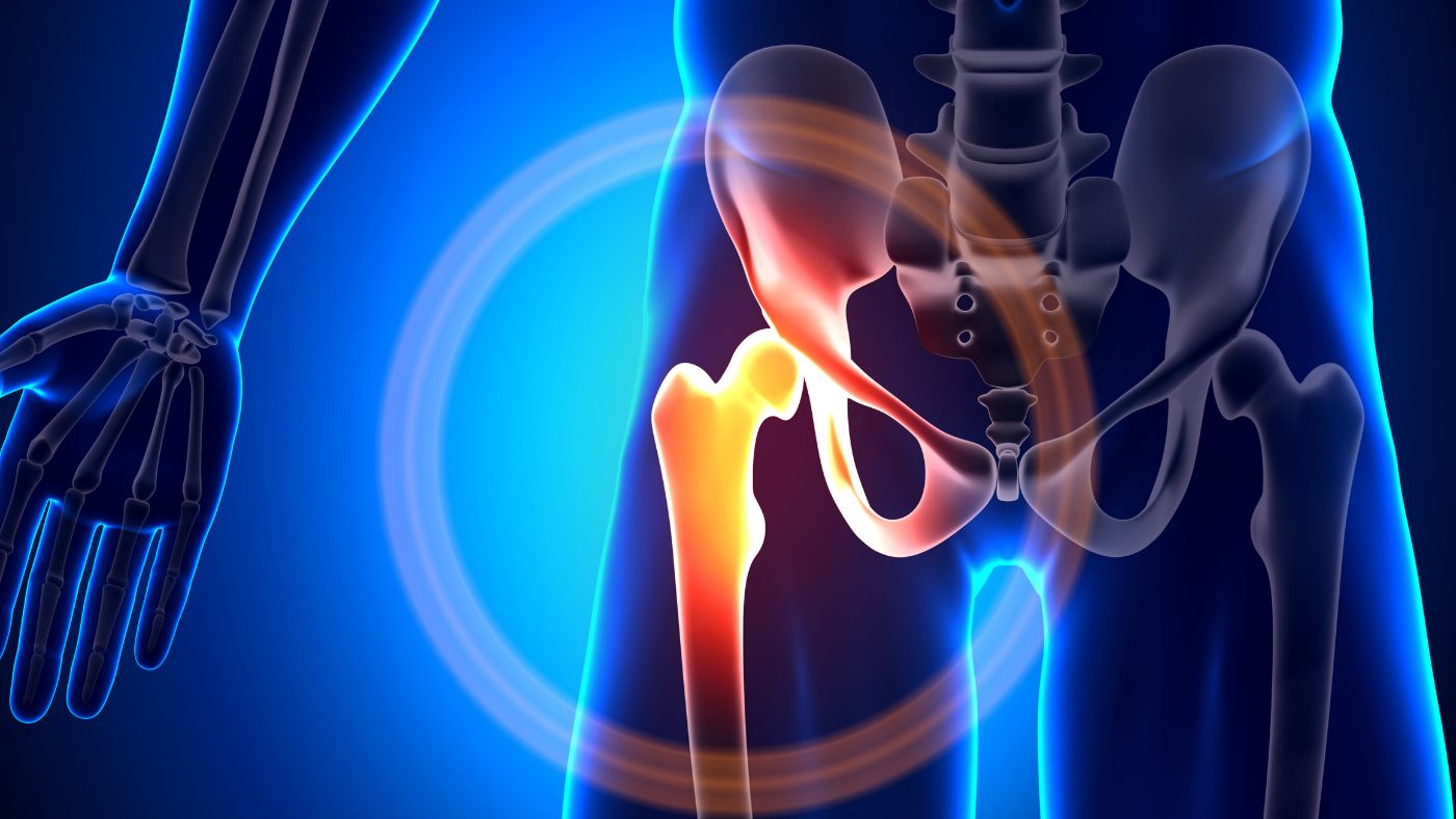 Hip: Hip Bursitis