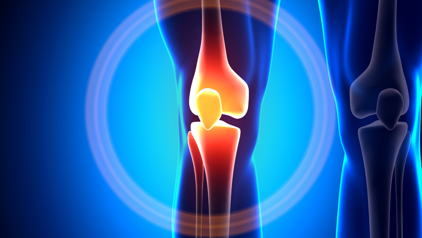 Knee: Posterior Cruciate Ligament (PCL) Injuries