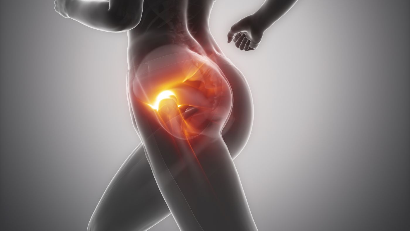 Hip: Hip Dysplasia