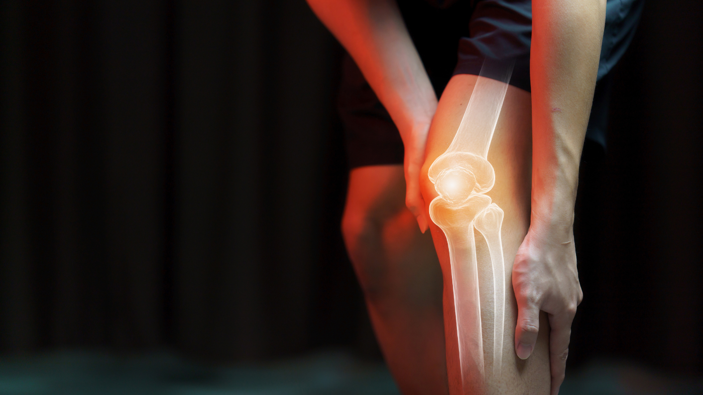 Knee: Patellar Tendinopathy