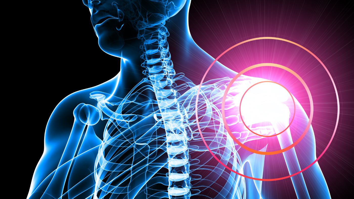 Shoulder: SLAP Tears