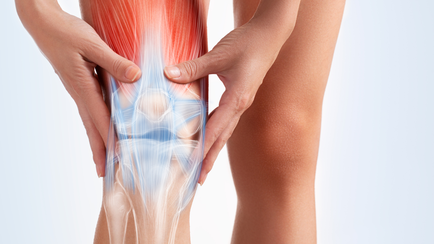 Knee: Post-Traumatic Arthritis