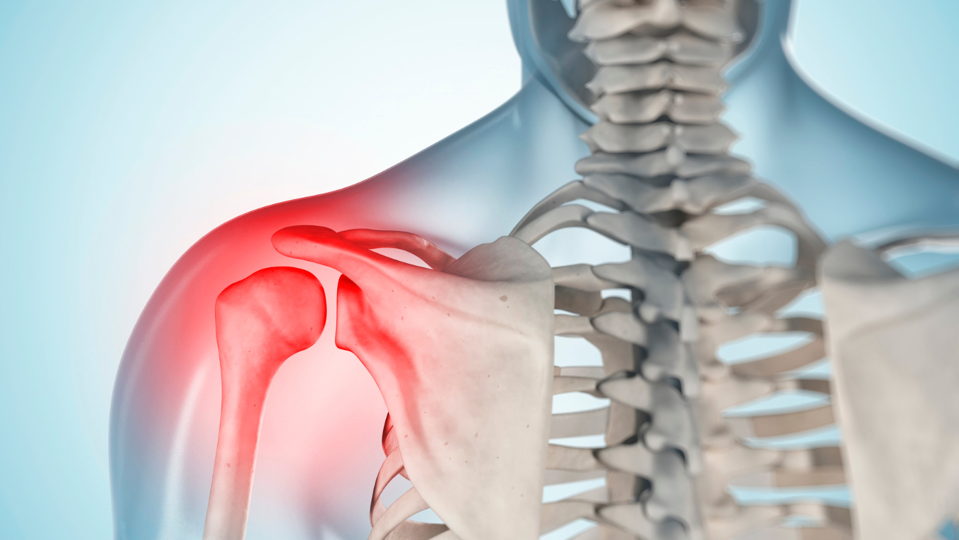 Shoulder: Shoulder Fractures
