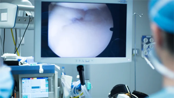 Knee: Arthroscopic ACL Reconstruction