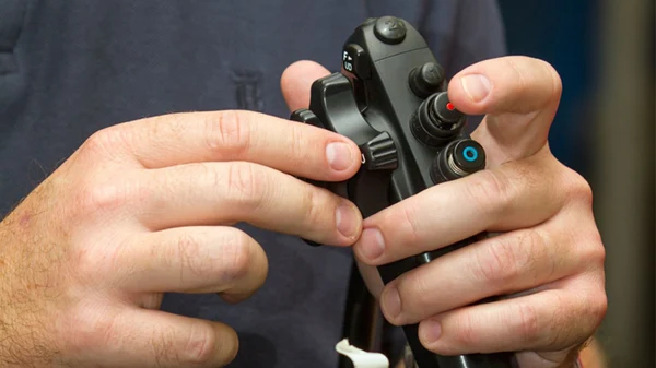 Knee: Arthroscopic Cartilage Repair