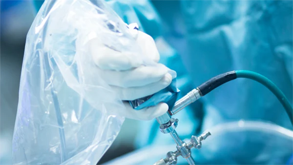 Knee: Arthroscopic Meniscus Surgery