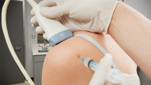 Shoulder: Corticosteroid Injections for Shoulder Pain