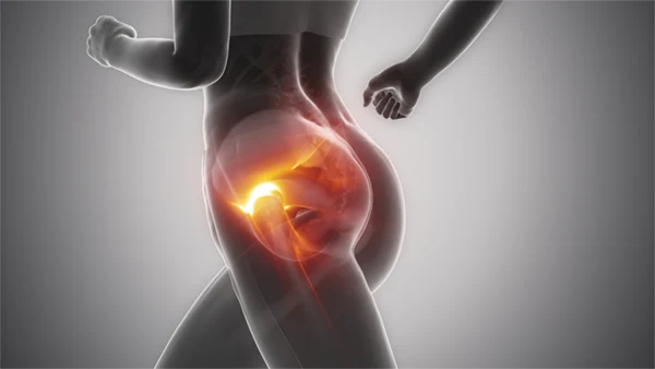 Hip: Hip Labral Repair Surgery