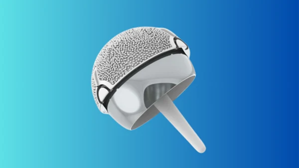 Hip: Hip Resurfacing Surgery