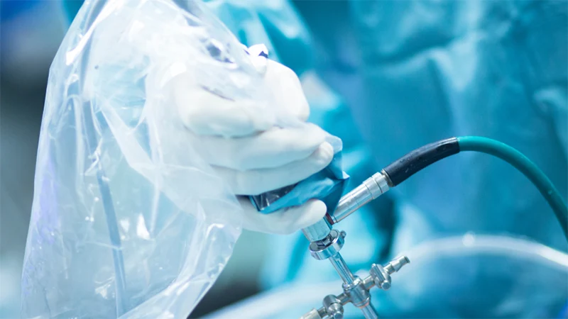 Shoulder: Arthroscopic Rotator Cuff Repair