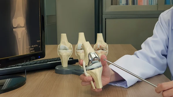 Knee: Total Knee Replacement